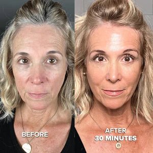 2 Month Supply - Collagen Mask - Image 3